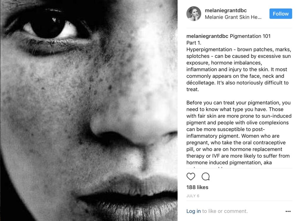 Notes on Hyperpigmentation